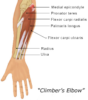 climbers-elbow copy